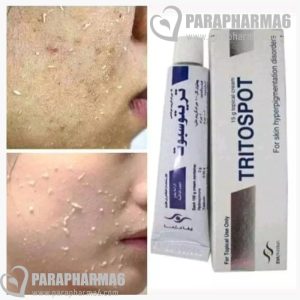 Tritospot Cream
